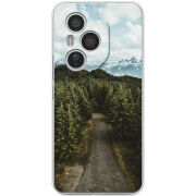 Чохол BoxFace Honor 400 Pro 