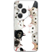 Чохол BoxFace Honor 400 Pro 