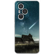 Чохол BoxFace Honor 400 Pro 