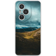 Чохол BoxFace Honor 400 Pro 