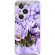 Чохол BoxFace Honor 400 Pro 