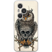 Чохол BoxFace Honor 400 Pro 