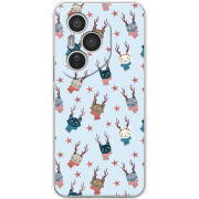 Чохол BoxFace Honor 400 Pro 