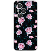 Чохол BoxFace Honor 400 Pro 