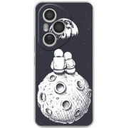 Чохол BoxFace Honor 400 Pro 