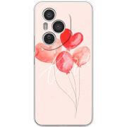 Чохол BoxFace Honor 400 Pro 