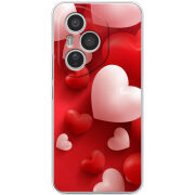 Чохол BoxFace Honor 400 Pro 