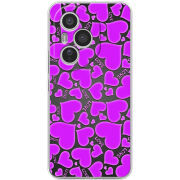 Чохол BoxFace Honor 400 Pro 