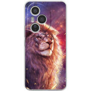 Чохол BoxFace Honor 400 Pro 