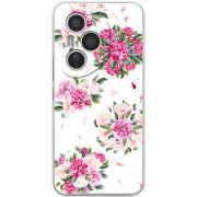 Чохол BoxFace Honor 400 Pro 