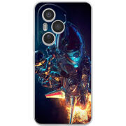 Чохол BoxFace Honor 400 Pro 