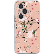 Чохол BoxFace Honor 400 Pro 