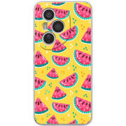 Чохол BoxFace Honor 400 Pro 