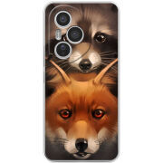 Чохол BoxFace Honor 400 Pro 