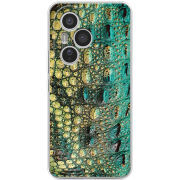 Чохол BoxFace Honor 400 Pro 