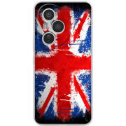 Чохол BoxFace Honor 400 Pro 