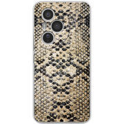 Чохол BoxFace Honor 400 Pro 