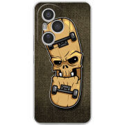 Чохол BoxFace Honor 400 Pro 