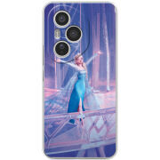 Чохол BoxFace Honor 400 Pro 