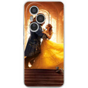 Чохол BoxFace Honor 400 Pro 