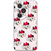 Чохол BoxFace Honor 400 Pro 