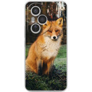 Чохол BoxFace Honor 400 Pro 