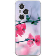 Чохол BoxFace Honor 400 Pro 