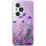 Чохол BoxFace Honor 400 Pro 