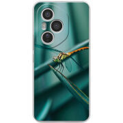 Чохол BoxFace Honor 400 Pro 