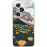 Чохол BoxFace Honor 400 Pro 