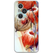 Чохол BoxFace Honor 400 Pro 