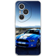 Чохол BoxFace Honor 400 Pro 