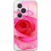 Чохол BoxFace Honor 400 Pro 