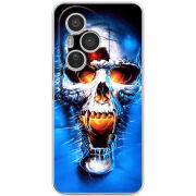 Чохол BoxFace Honor 400 Pro 