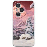 Чохол BoxFace Honor 400 Pro 