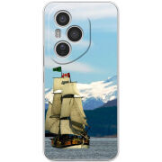 Чохол BoxFace Honor 400 Pro 