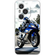 Чохол BoxFace Honor 400 Pro 