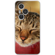 Чохол BoxFace Honor 400 Pro 