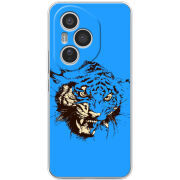 Чохол BoxFace Honor 400 Pro 