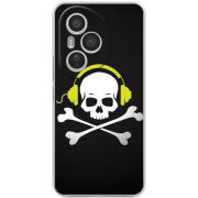 Чохол BoxFace Honor 400 Pro 