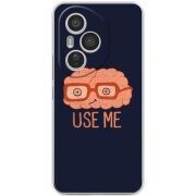 Чохол BoxFace Honor 400 Pro 