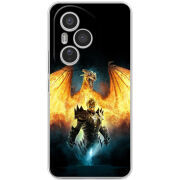 Чохол BoxFace Honor 400 Pro 