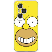 Чохол BoxFace Honor 400 Pro 