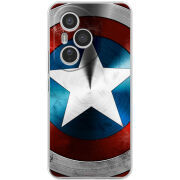 Чохол BoxFace Honor 400 Pro 