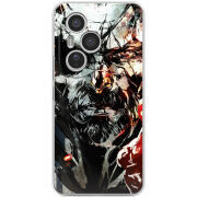 Чохол BoxFace Honor 400 Pro 