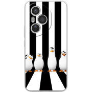 Чохол BoxFace Honor 400 Pro 