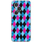 Чохол BoxFace Honor 400 Pro 