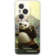 Чохол BoxFace Honor 400 Pro 