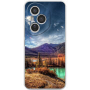 Чохол BoxFace Honor 400 Pro 