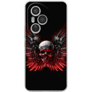 Чохол BoxFace Honor 400 Pro 